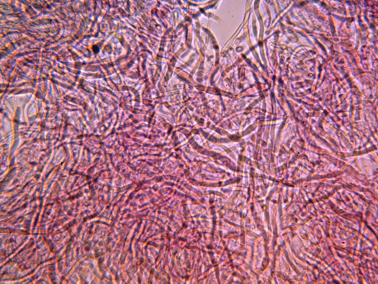Microscopía de Poronia punctata - 18 - Endostroma Floxina x 400